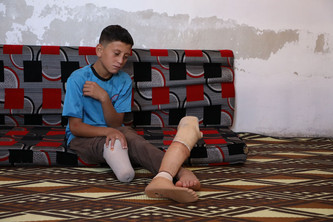 Mohammed sitzt auf einem bunten Sofa und betrachtet seine ausgezogene Prothese.